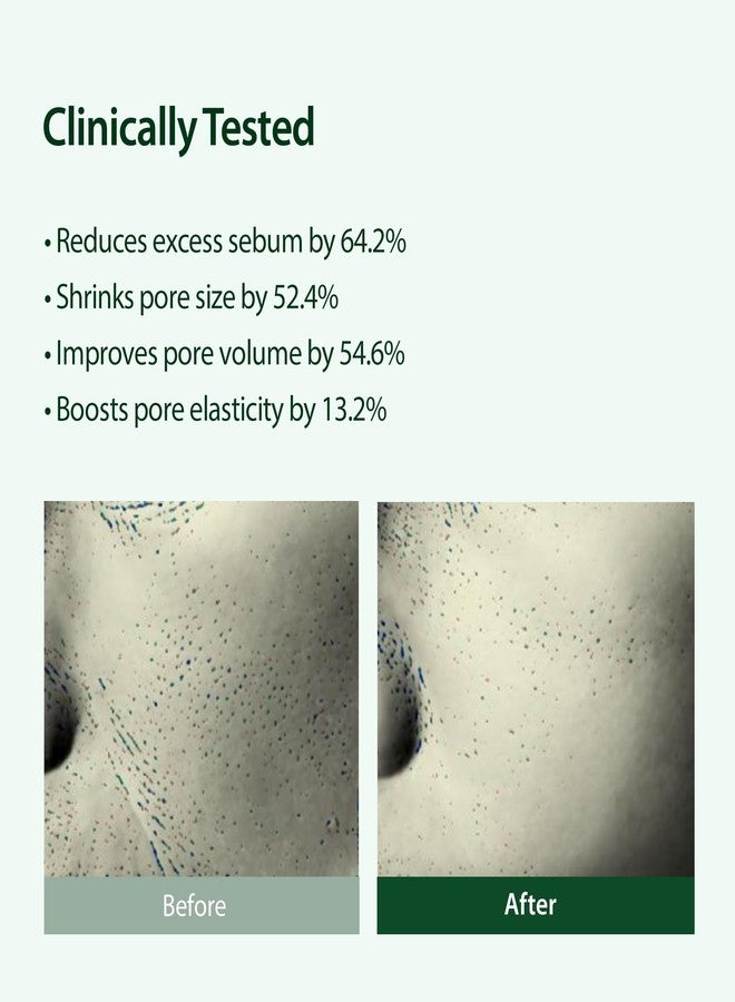 بلايث سيروم بليث المُستهدف للمسام مع 22% نياسيناميد للتحكم في إفراز الزيوت، وتصغير المسام للوجه، عناية كورية بالبشرة – 30 مل - Image 4